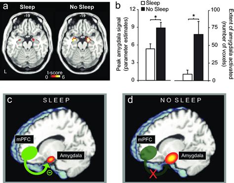 The Impact Of Sleep Deprivation On Emotional Brain Reactivity And