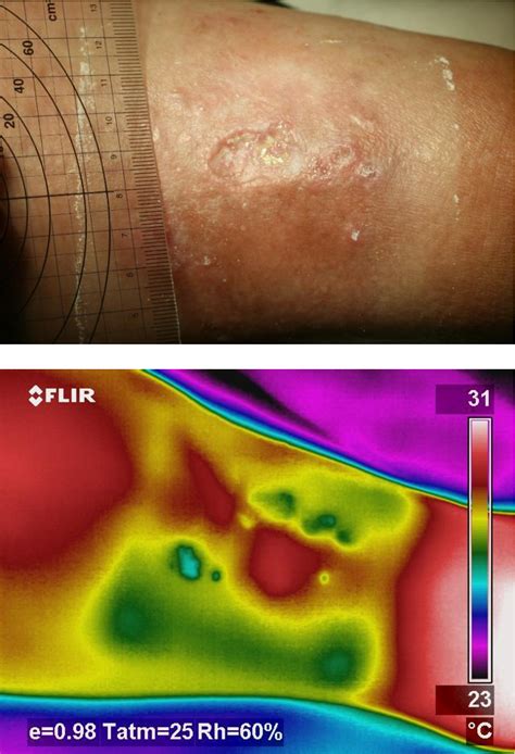Figure 1 From The Application Of Passive Thermography And Measurement