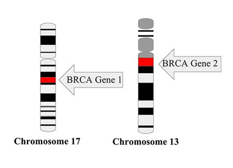 Cancer Risk For Women Carrying Brca Mutations National Cancer Institute