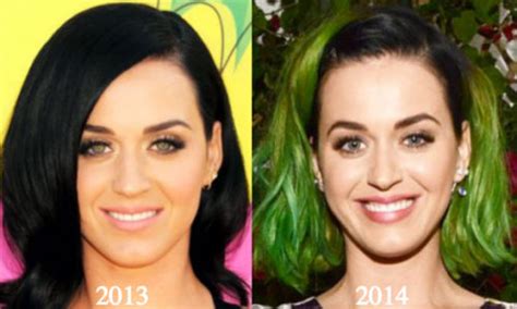 Katy Perry Plastic Surgery Before And After Photos Latest Plastic
