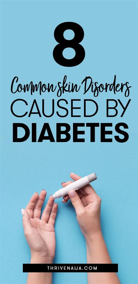 8 Common Skin Problems Caused By Diabetes Thrivenaija