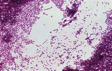 Microscopic Examination Of Listeria Monocytogenes With Gram Stain Of
