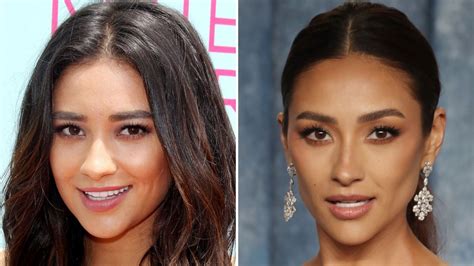 Has Shay Mitchell Had Plastic Surgery Before After Photos