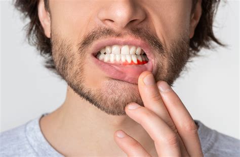 What Are Common Symptoms Of An Infected Gum St Albert