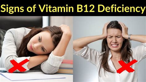 Signs And Symptoms Of Vitamin B Deficiency YouTube