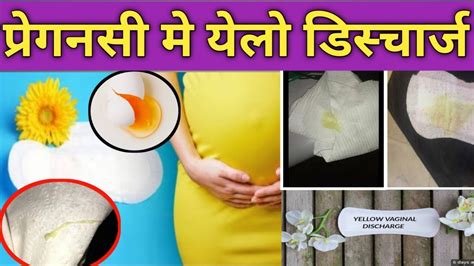 Yellow Discharge During Pregnancy।yellow Discharge Pregnancy Sign