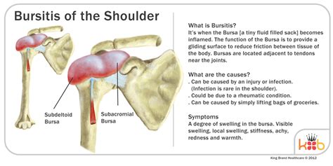 Shoulder Bursitis Anatomy