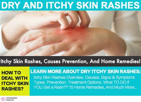 Itchy Skin Rashes Causes Prevention And Remedies