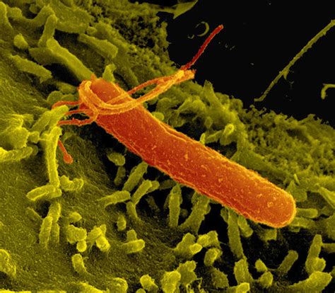 Helicobacter Pylori Infection Bacteria Symptoms Test Treatment