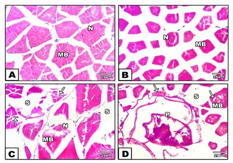 Photomicrograph Showing The Histological Features Of The Muscle Fibers
