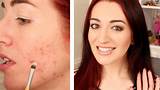Pictures of How To Cover A Pimple With Makeup