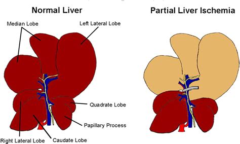 Quadrate Lobe Of Liver
