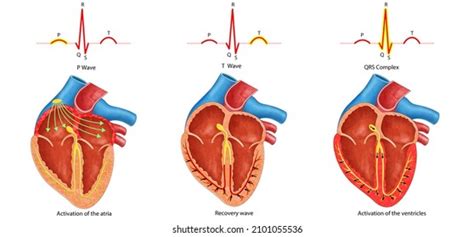 Ecg Waveform Explained Ekg Labeled Diagrams And Components