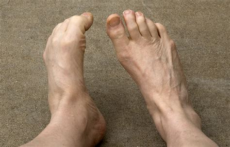Some Of Us Still Possess Ape Like Feet Science Buzz