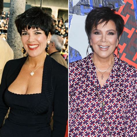 Kris Jenner Plastic Surgery Photos Of Kuwtk Star Then And Now Life And Style