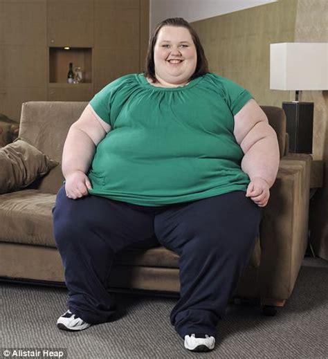 Obesity Crisis The Super Obese Patients Who Cost The Nhs