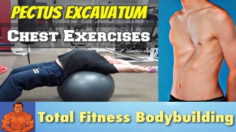 Chest Stretching Exercises For Pectus Excavatum Sunken Chest Youtube