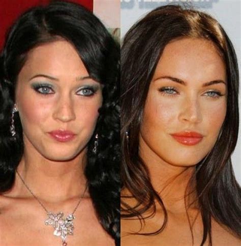 Megan Fox Before And After Surgery Before And After Pinterest