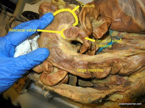 The video includes gross anatomy of small intestine, large intestine, their parts and comparison. VCD - Organs of the Abdomen