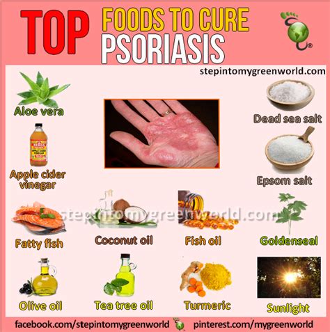 Psoriasis Psoriasis Diet Psoriasis Cure Psoriasis Recipes