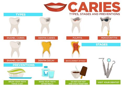 Dental Caries Infographic