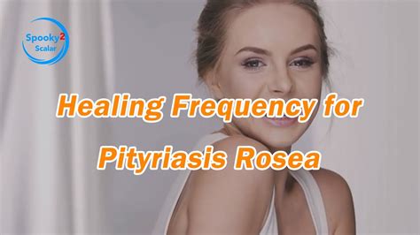 Healing Frequency For Pityriasis Rosea Youtube