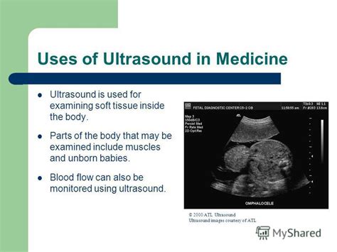 Презентация на тему Ultrasound In Medicine Standard Grade Physics