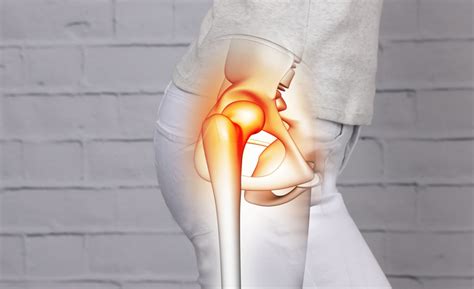 Hip Pain Recover Physio Hastings