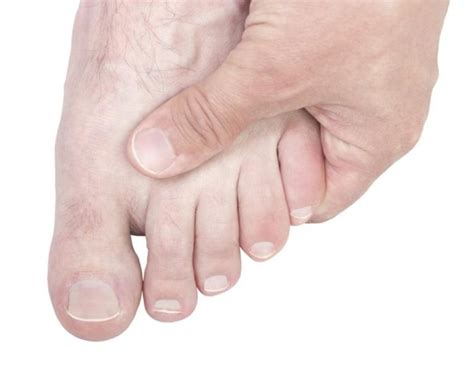 How To Cure Your Top Of Foot Pain Health Synonyms