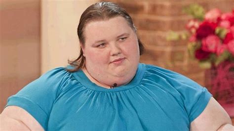 Obese Uk Woman Georgia Davis Loses 115 Kilos ‘to Live And Be Normal