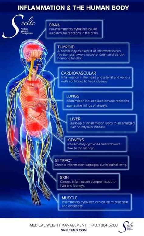 Without an immune system, our bodies would be our white blood cells are stored in different places in the body, which are referred to as lymphoid organs. Inflammation & The Human Body