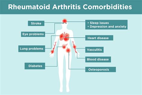 Rheumatoid Arthritis Complications What Ra Patients Need To Know Free