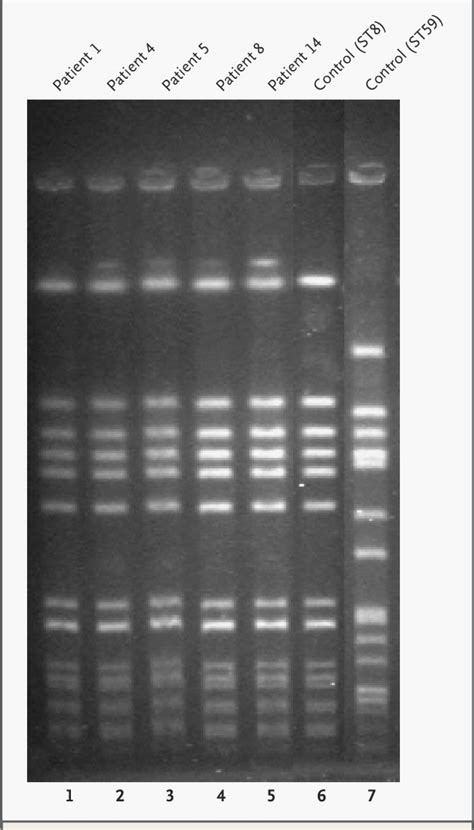 Gel electrophoresis in which the gel is subjected to electric fields alternating between different angles. Pulsed-Field Gel Electrophoresis of SmaIDigested DNA from ...