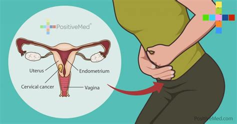 7 Warning Signs Of Cervical Cancer That Women Often Ignore Positivemed