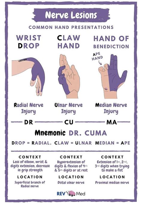 Hand Nerve Injuries Common Presentations • Wrist Grepmed