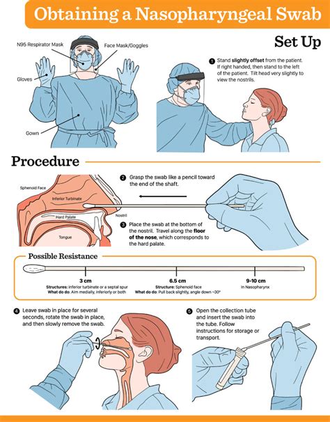 How To Perform A Nasopharyngeal Swab An Otolaryngology Perspective