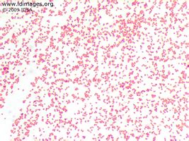 A microbial biorealm page on the genus neisseria gonorrhoeae. Neisseria Images - Partners Infectious Disease Images ...