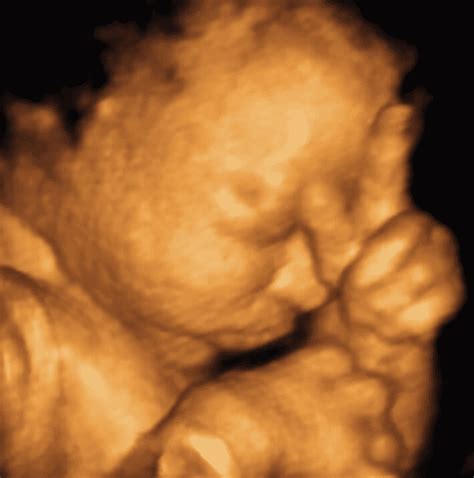33 Weeks And 2 Days Pregnant Baby Fetal Progress Ultrasound