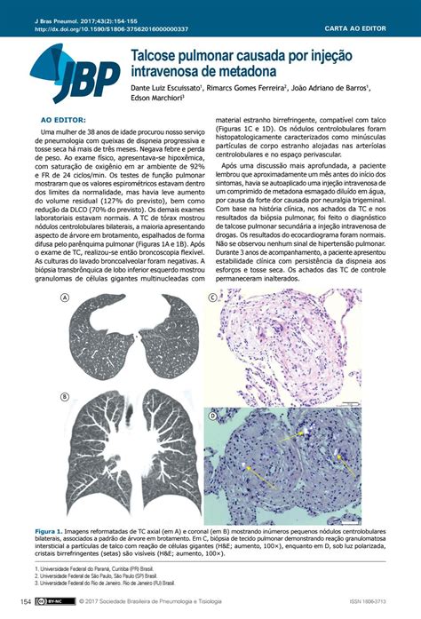 Jornal Brasileiro De Pneumologia Volume 43 Número 2 Marçoabril