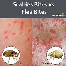 Veterinarians treat flea allergy dermatitis in a number of ways, but treatment always begins with elimination of the flea infestation. Flea Control - Jones Pest Control Inc.