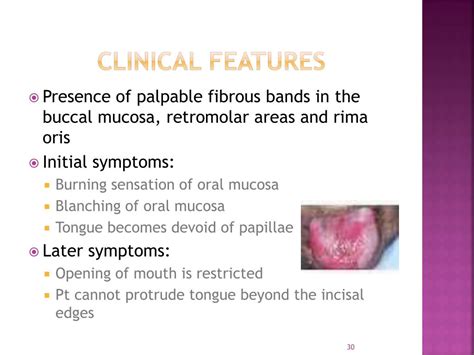 Ppt Epidemiology Etiology And Prevention Of Oral Cancer Powerpoint