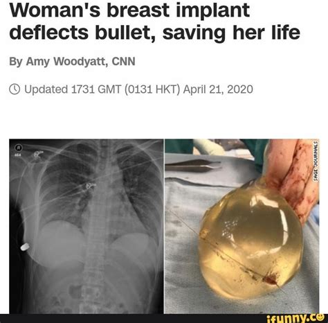Woman S Breast Implant Deflects Bullet Saving Her Life By Amy Woodyatt