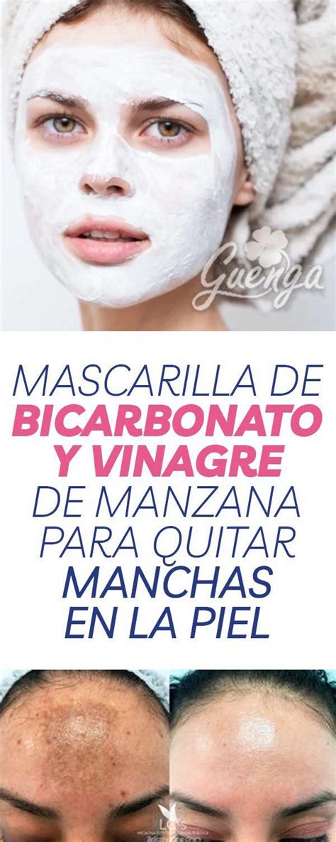 Rmag26 Mascarilla De Bicarbonato Y Vinagre De Manzana Para Quitar