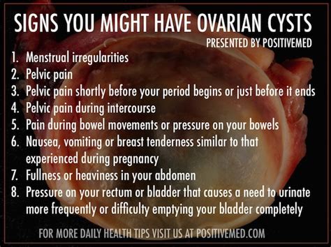 What You Should Know About Ovarian Cysts Symptoms Positivemed