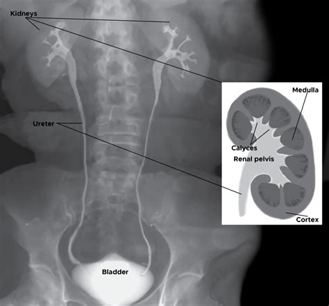 Kidney Ureter Bladder Anatomy