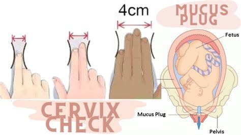 Pregnancy Cervix Check Mucus Plug Youtube