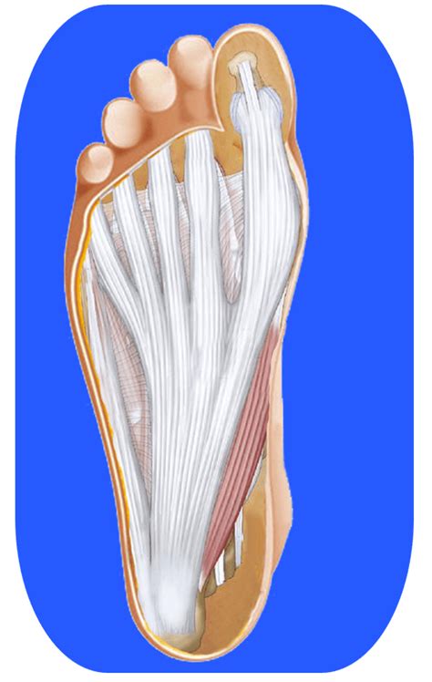 Plantar Fasciitis Pain Treatment Nyc Foot And Ankle Clinic
