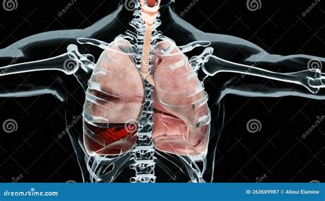 D Ilustración de Pneumotórax pulmón normal versus colapso síntomas