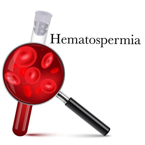 Hematospermia Blood In Semen Causes Symptoms Treatment