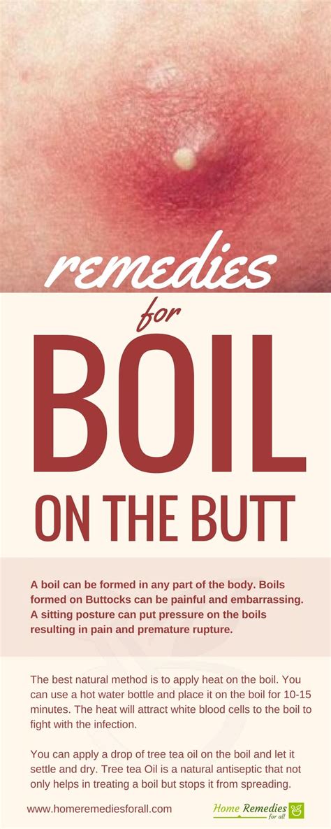 What Causes Boils On Buttocks How To Get The Core Out Of A Boil What